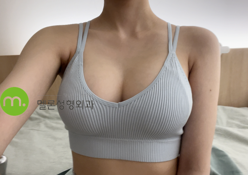 B컵과 D컵의 차이는 얼마나 클까? 멘토 엑스트라 후기