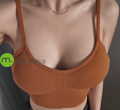 뼈마름도 가슴수술 가능할까?! 멜론성형외과 후기!