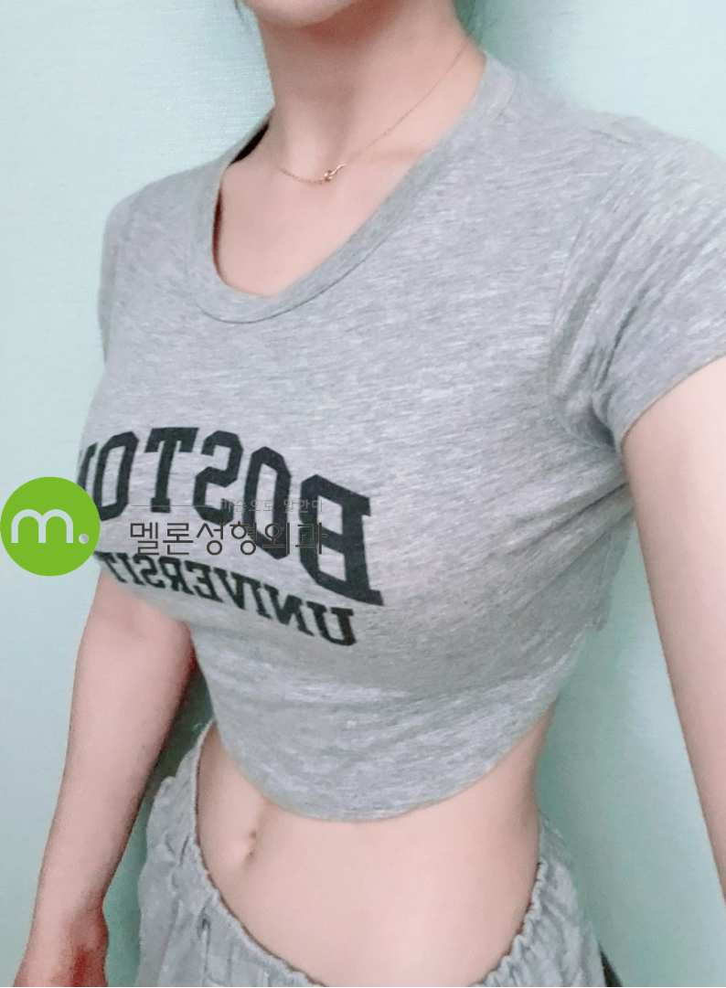 모티바 데미 가슴수술후기 허리까지 얇아보인다!