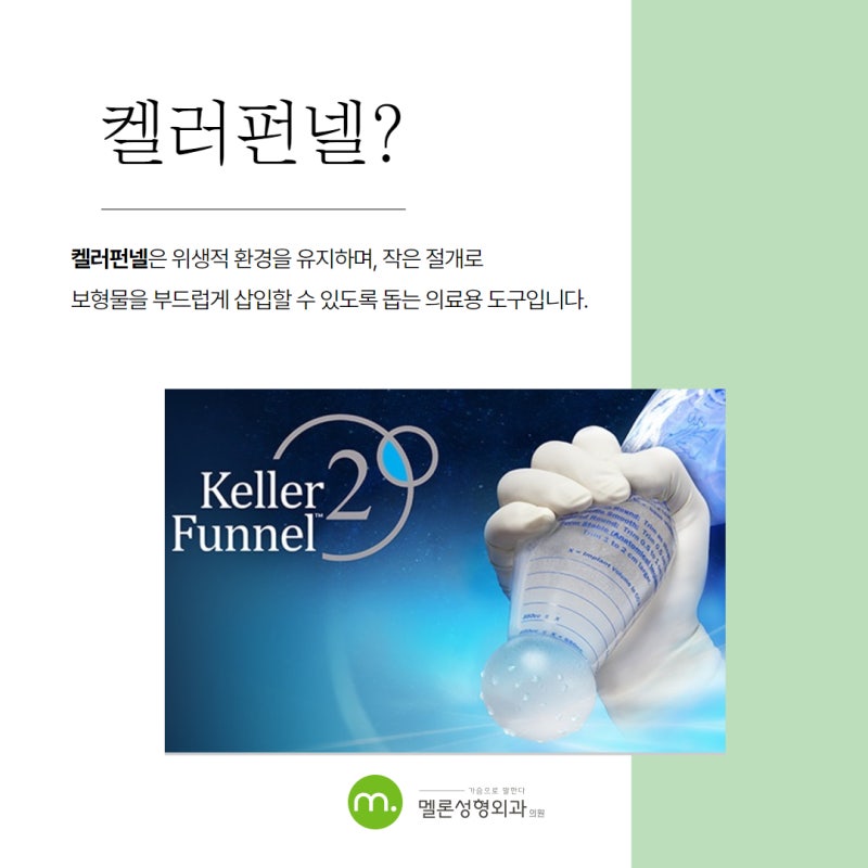 가슴성형 부작용 '켈러펀넬'로 최소화