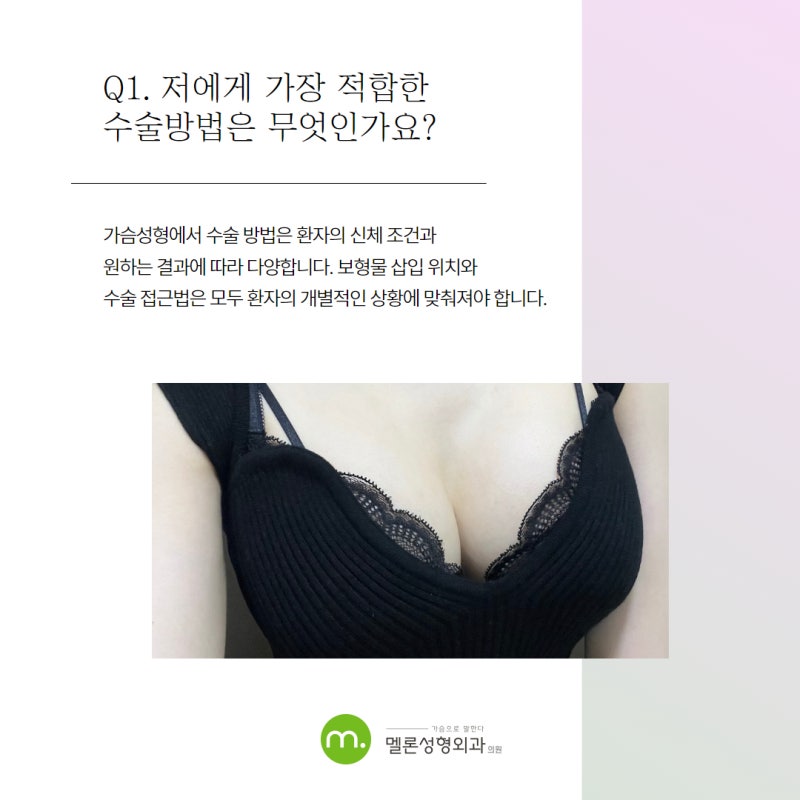 가슴성형 상담 질문 리스트 정리