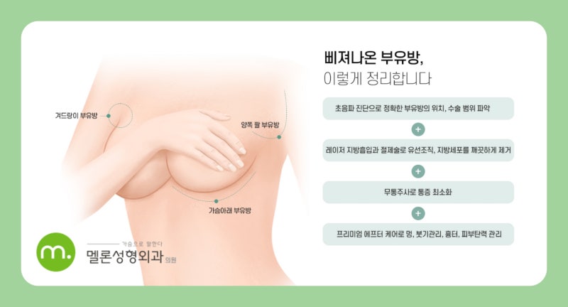 副乳、手術すべき?原因と解決法
