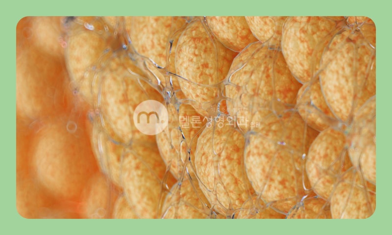 正在考慮隆乳填充物?請先了解風險和副作用!