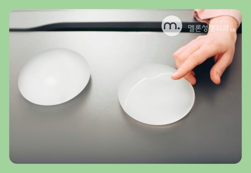 Nâng ngực không lộ dấu vết? Cách phẫu thuật mà không ai biết