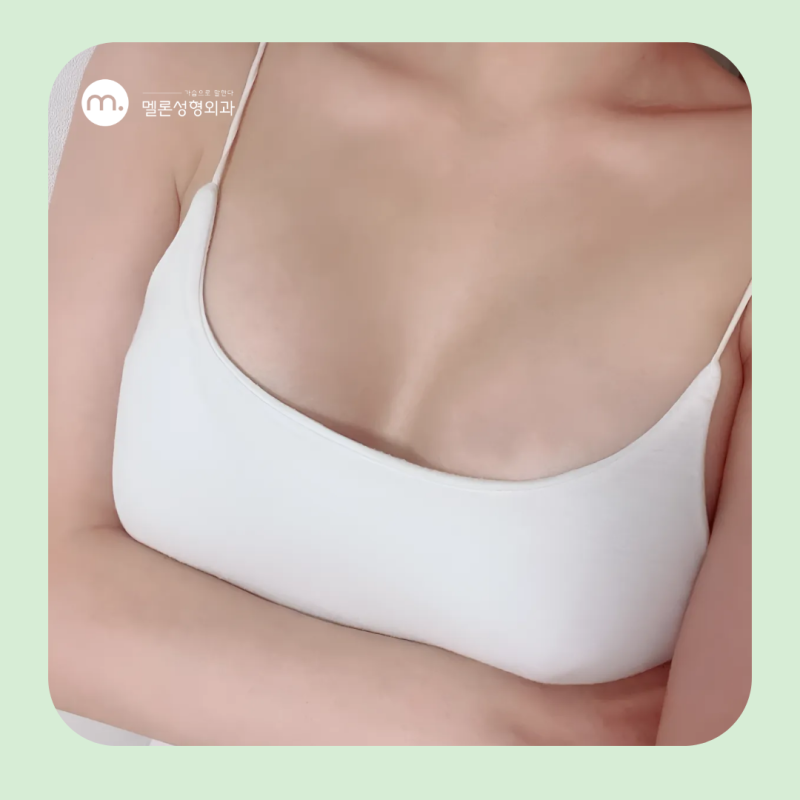 江南產後胸部下垂、變小,可透過隆乳手術改善