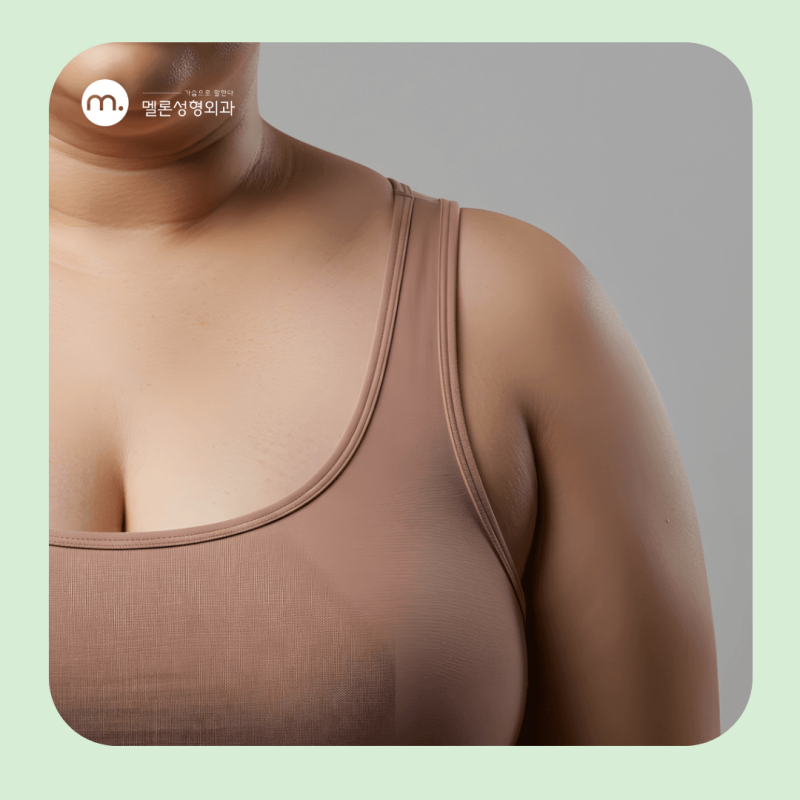江南腋下副乳手术后记?肿块、疼痛去除方法