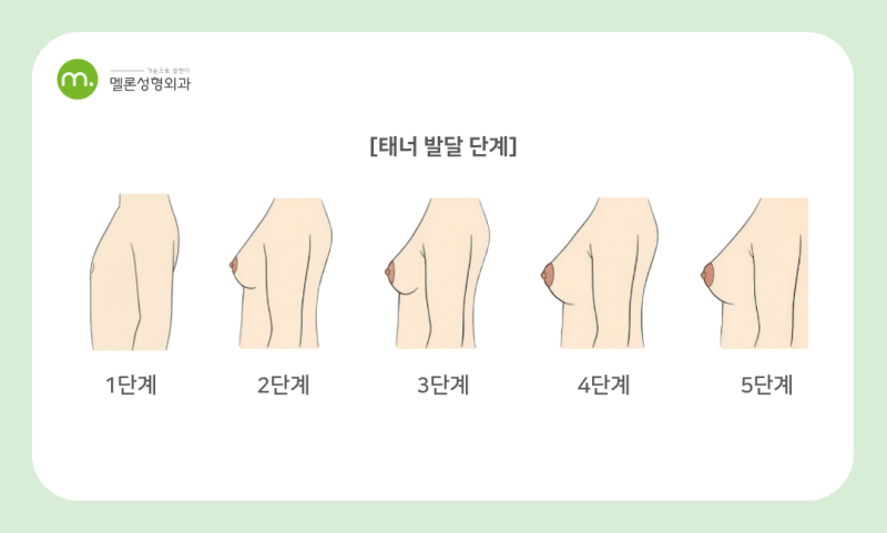 가슴 크기 유전? 가슴 커지는 시기와 방법