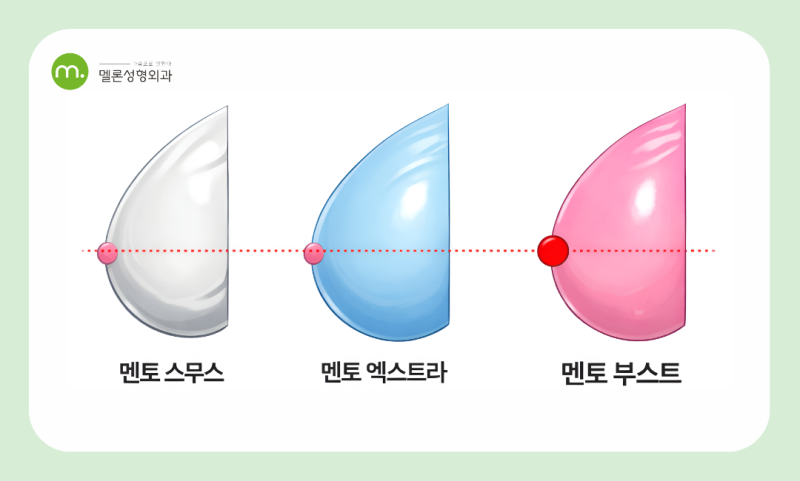강남 멘토 보형물, 부스트 vs 엑스트라 vs 스무스 종류 비교 분석