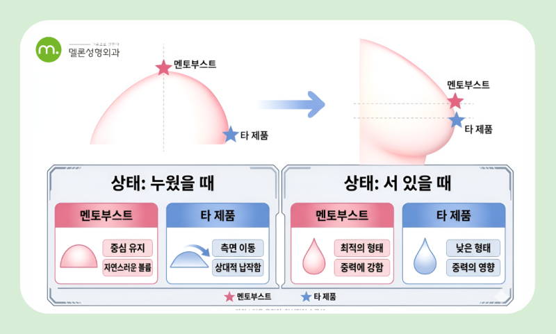 강남 멘토 보형물 종류, 멘토 부스트의 구조와 촉감 차이