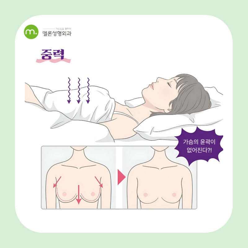 강남역 가슴 재수술, 불만족 개선까지 원한다면 '이 때' 수술하세요
