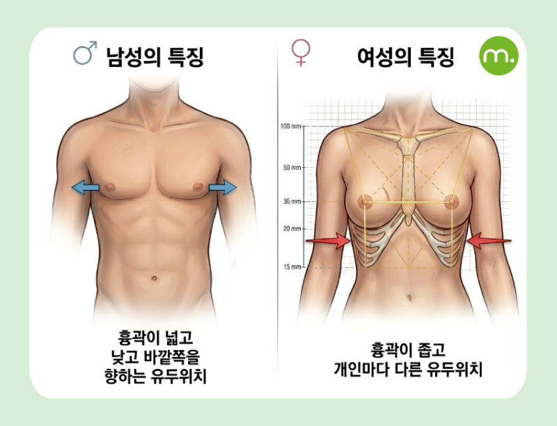 강남 MTF 가슴성형, 일반 가슴수술과 무엇이 다를까?