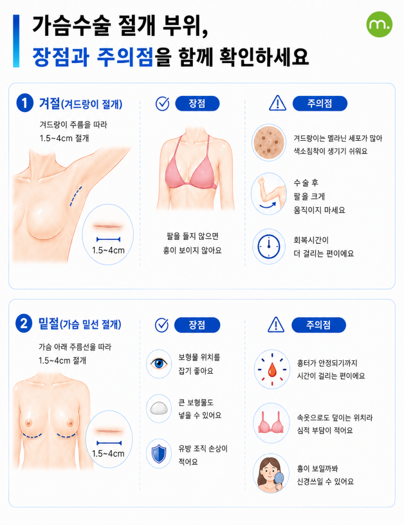 가슴성형 겨절, 밑절 고민된다면? 절개 부위 선택부터 켈로이드 흉터 관리까지 사진 3