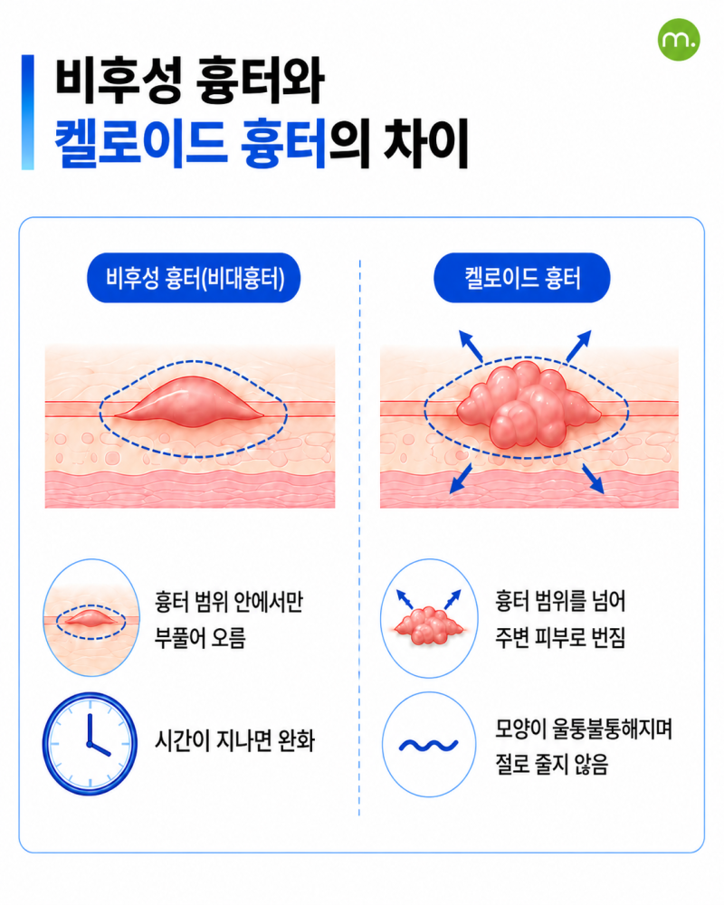 가슴성형 겨절, 밑절 고민된다면? 절개 부위 선택부터 켈로이드 흉터 관리까지 사진 4
