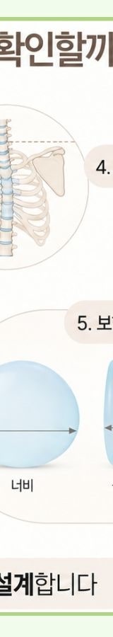 유방 전절제 후 재건 I 모티바 보형물의 지연재건 사례 사진 17